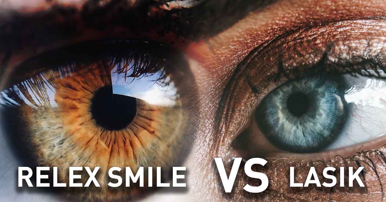 Read more about the article Your Guide to LASIK and SMILE Eye Surgery in Hong Kong: Costs, Coverage, and What You Need to Know