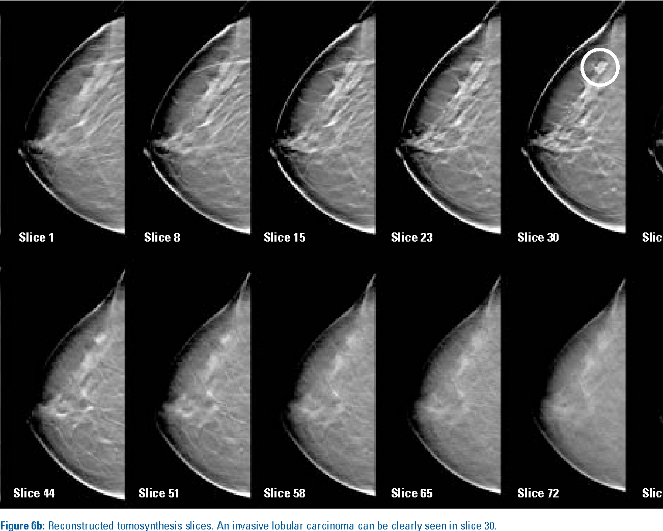 Read more about the article Advancing Breast Imaging: New Technologies and Applications