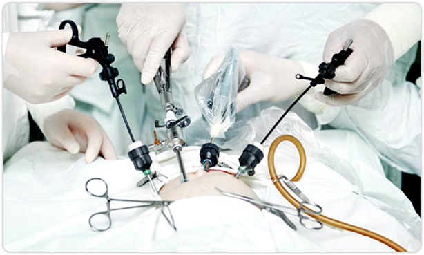 Read more about the article Laparoscopic Surgery in HK: Cost, Recovery & Top Clinics