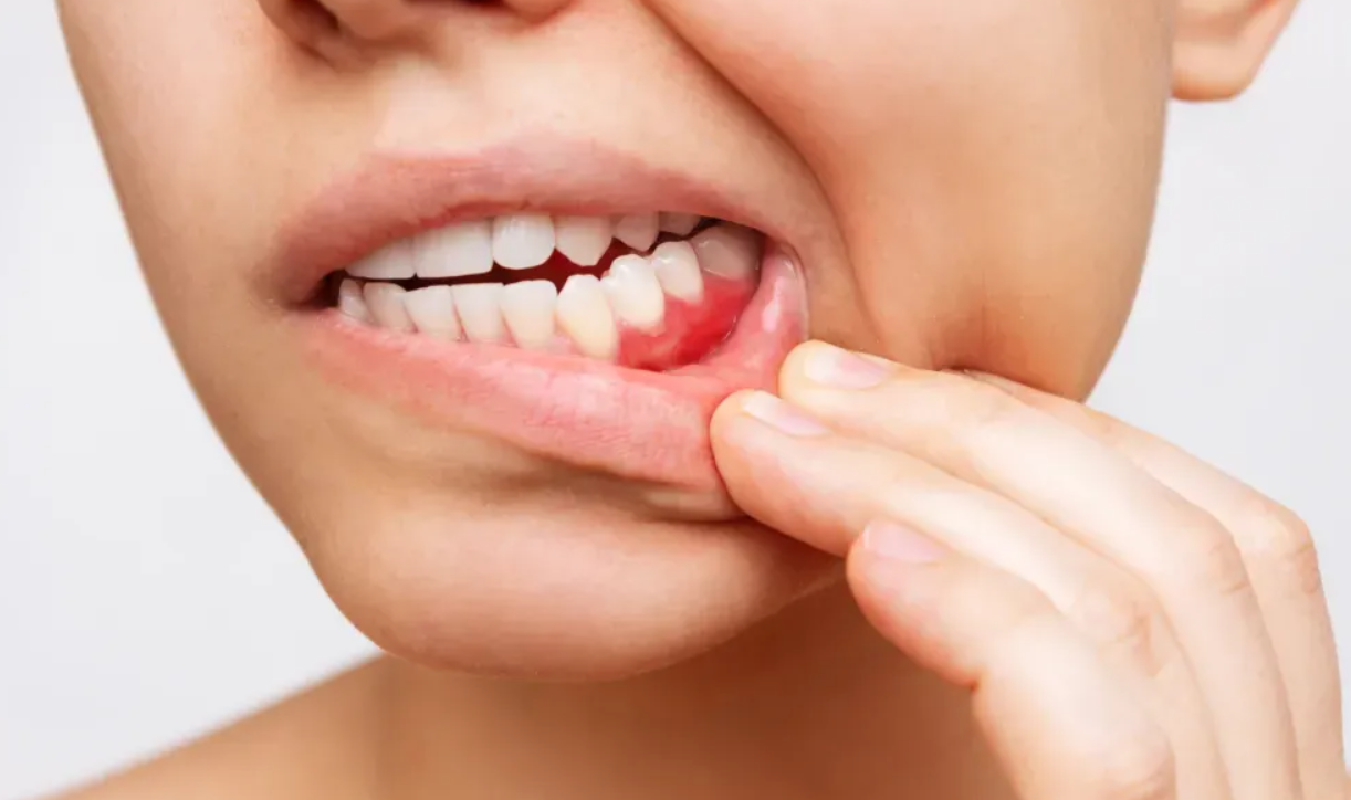 Read more about the article Identifying High-Risk Groups for Oral Cancer in Hong Kong