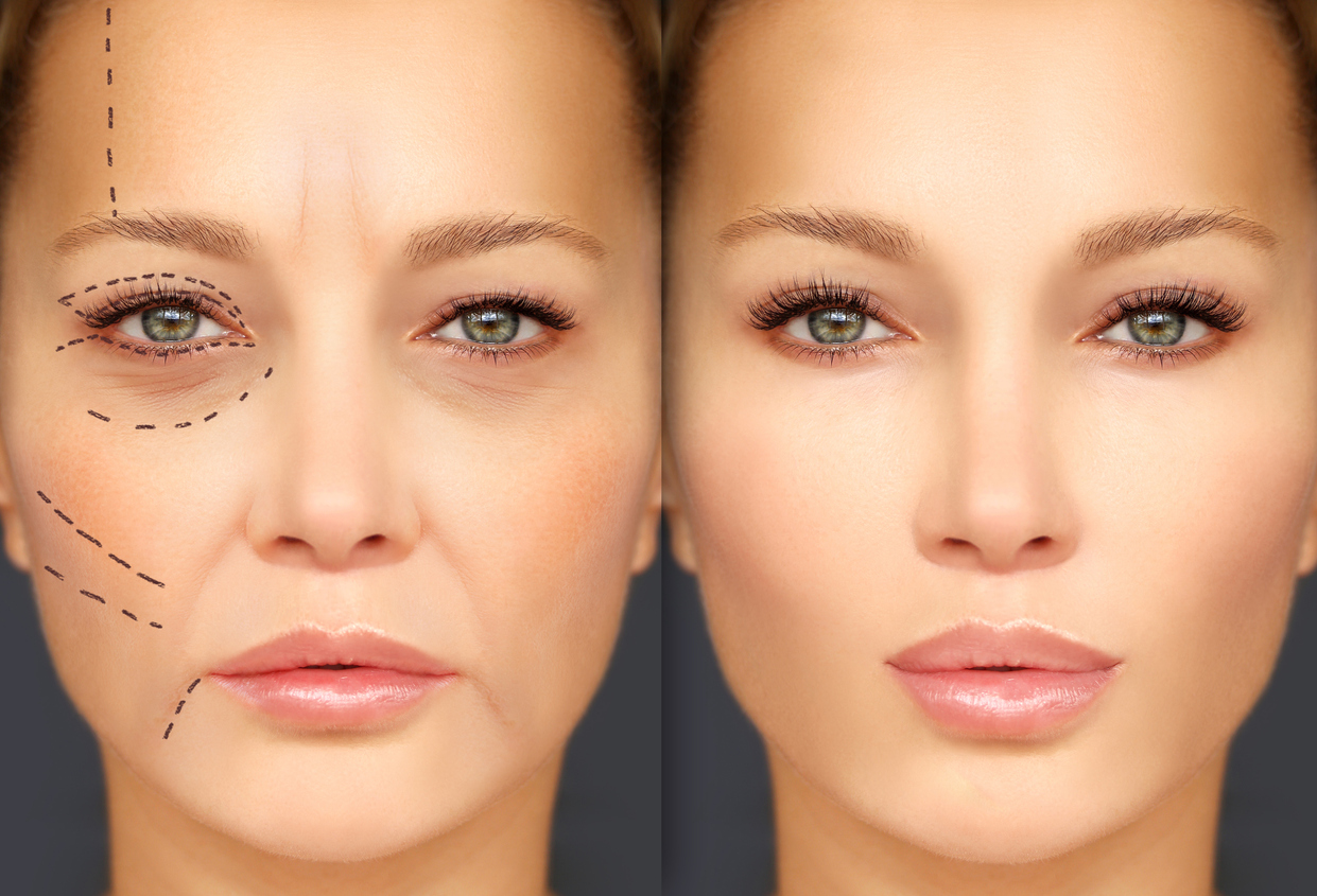 Read more about the article Top Plastic Surgery Tips for Natural Beauty in HK