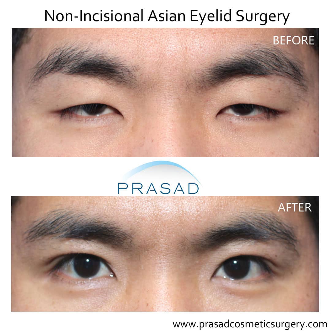 Read more about the article Top Plastic Surgery Trends & Clinics in HK