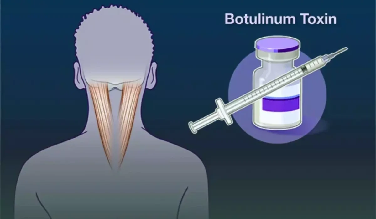 Botox in HK: Costs, Clinics & Care Tips