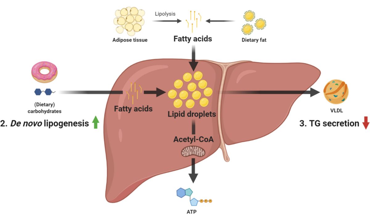 HKU Faculty of Medicine Study Shows Excessive Fat Hampers Liver Cancer Immunotherapy Success Promotes Healthier Diets to Protect Liver