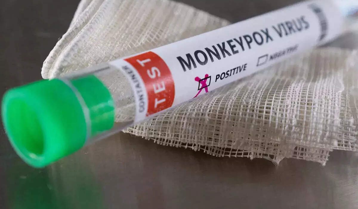 20-Year-Old Man Infected With Monkeypox in Stable Condition After High-Risk Contact in Hong Kong During Incubation Period