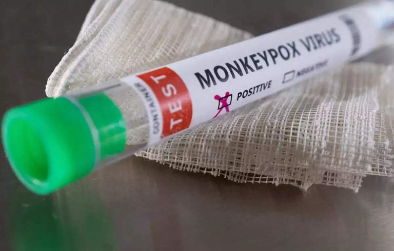 20-Year-Old Man Infected With Monkeypox in Stable Condition After High-Risk Contact in Hong Kong During Incubation Period