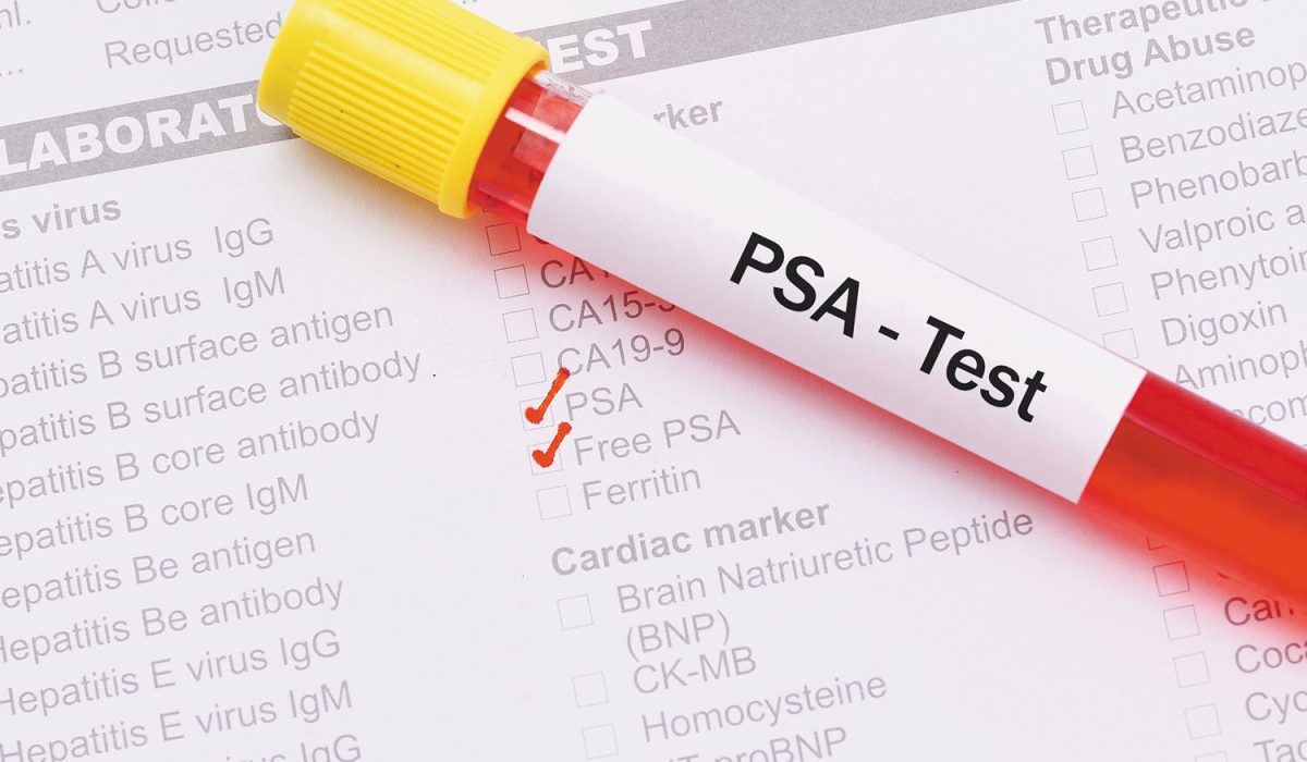 HA Recalls PSA Test Reagent: What Patients Need to Know