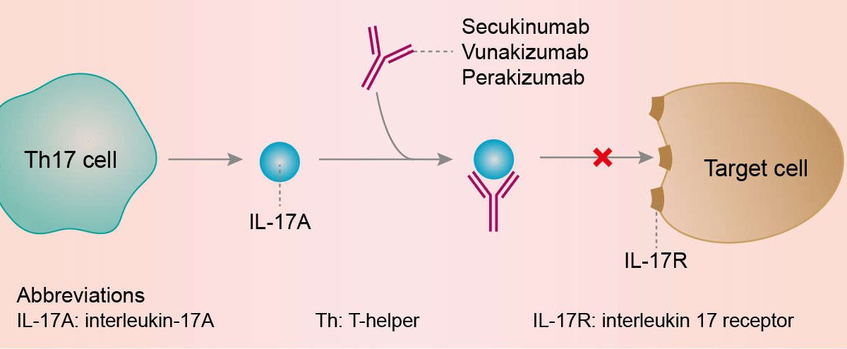 Secukinumab Repairs Bone Damage in Psoriatic Arthritis