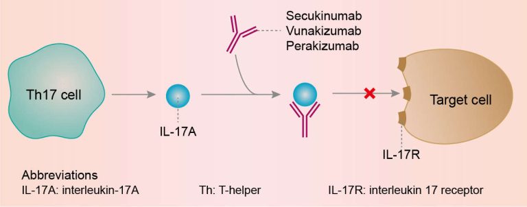 Secukinumab Repairs Bone Damage in Psoriatic Arthritis