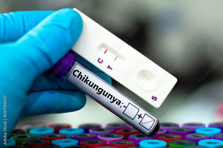 Hong Kong Boosts Chikungunya Virus Testing Amid Rising Cases
