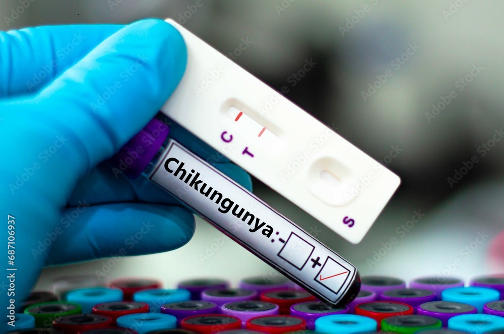 Hong Kong Boosts Chikungunya Virus Testing Amid Rising Cases