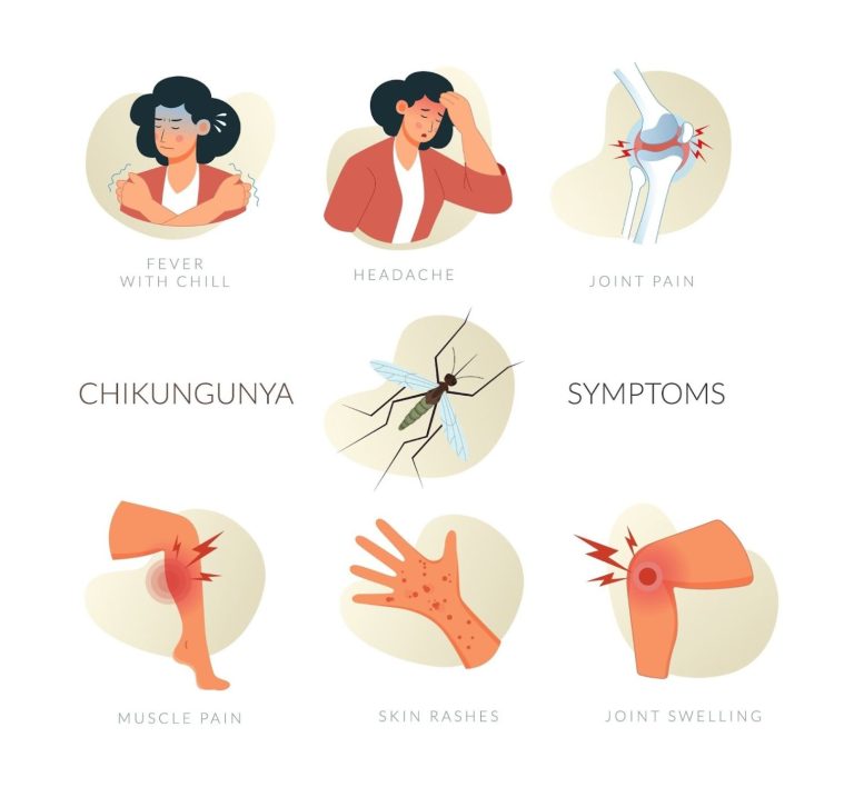 Hong Kong Reports Imported Chikungunya Fever Case
