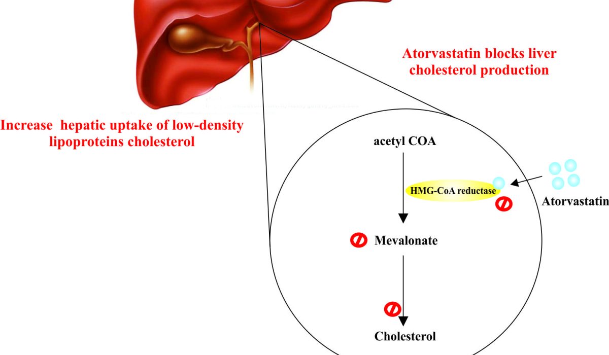 HKU Study: Atorvastatin May Fight Liver Cancer