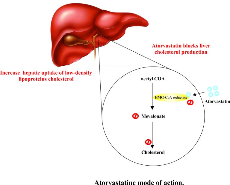 HKU Study: Atorvastatin May Fight Liver Cancer